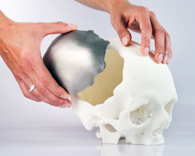 3D Printed Medical Devices
