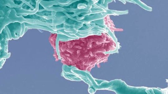 Immuntherapie mit dendritischen Zellen