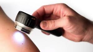 Digital Dermatoscope