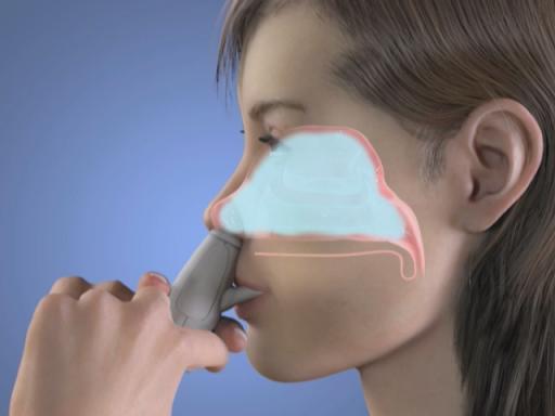 Nasal Drug Delivery Technology