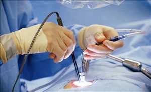Spinal Implants and Surgical Devices