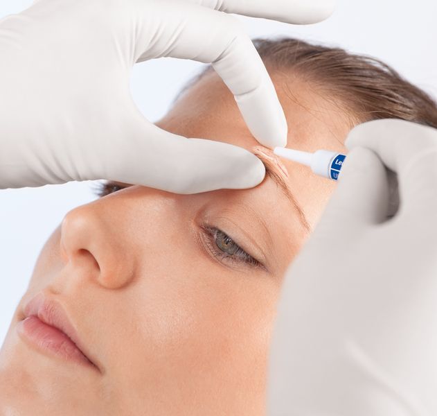 Surgical Glue